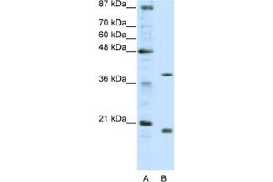 Western Blotting (WB) image for anti-Zinc Finger Protein 322A (ZNF322A) antibody (ABIN2461934) (ZNF322A 抗体)