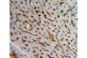 Used in DAB staining on fromalin fixed paraffin-embedded heart tissue (Angiopoietin 4 抗体  (AA 270-490))