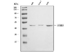 Western blot analysis of Aurora A/AURKA using anti-Aurora A/AURKA antibody (ABIN7600751).