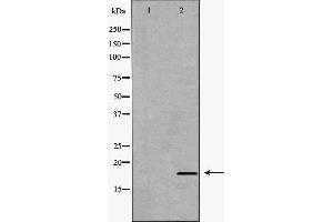 Western blot analysis of extracts of hela , using IL17A antibody. (Interleukin 17a 抗体  (Internal Region))