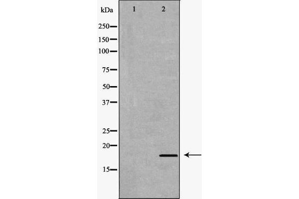 Interleukin 17a 抗体  (Internal Region)