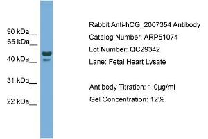 WB Suggested Anti-hCG_2007354  Antibody Titration: 0. (hCG_2007354 (N-Term) 抗体)