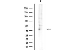 Western blot analysis of lysates from COLO205 cells(heat-shock treatment), using KCNK16 Antibody at 1/1000 dilution.