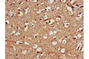 Immunohistochemistry of paraffin-embedded human brain tissue using ABIN7161445 at dilution of 1:100 (Neuroserpin 抗体  (AA 191-240))
