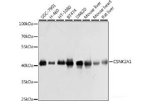 Western blot analysis of extracts of various cell lines using CSNK2A1 Polyclonal Antibody at dilution of 1:1000. (CSNK2A1/CK II alpha 抗体)