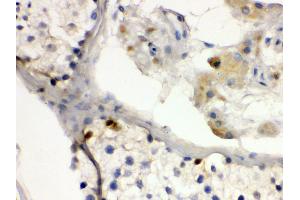 Anti- DMRT1 antibody,IHC(P) IHC(P): Human Testis Tissue (DMRT1 抗体  (N-Term))