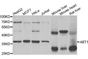 Western Blotting (WB) image for anti-Activator of Basal Transcription 1 (Abt1) antibody (ABIN1876937) (Activator of Basal Transcription 1 抗体)