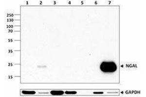 Western Blotting (WB) image for anti-Lipocalin 2 (LCN2) antibody (ABIN2665287) (Lipocalin 2 抗体)