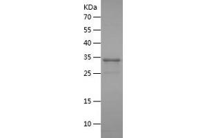 Western Blotting (WB) image for Hydroxysteroid (17-Beta) Dehydrogenase 3 (HSD17B3) (AA 67-178) protein (His-IF2DI Tag) (ABIN7283409) (HSD17B3 Protein (AA 67-178) (His-IF2DI Tag))