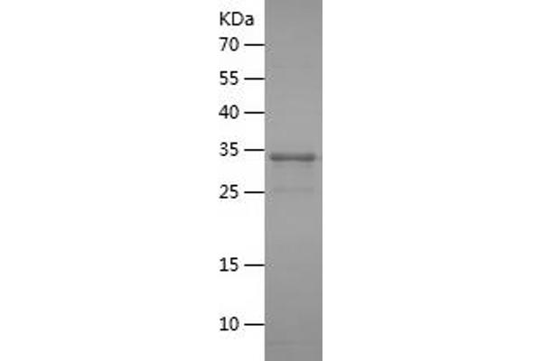 HSD17B3 Protein (AA 67-178) (His-IF2DI Tag)