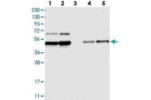 Western blot analysis of Lane 1: RT-4, Lane 2: U-251 MG, Lane 3: Human Plasma, Lane 4: Liver, Lane 5: Tonsil with FAM172A polyclonal antibody  at 1:250-1:500 dilution. (Fam172a 抗体)