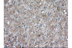 Immunohistochemical staining of paraffin-embedded Human prostate tissue using anti-BCL10 mouse monoclonal antibody. (BCL10 抗体)