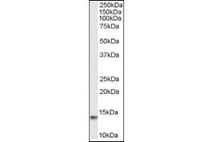 Image no. 1 for anti-Macrophage Migration Inhibitory Factor (Glycosylation-Inhibiting Factor) (MIF) (C-Term) antibody (ABIN374566) (MIF 抗体  (C-Term))