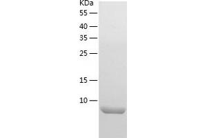 Western Blotting (WB) image for Defensin, beta 1 (DEFB1) (AA 22-68) protein (His tag) (ABIN7122618) (beta Defensin 1 Protein (AA 22-68) (His tag))