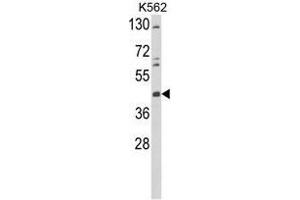 Western blot analysis of TAT Antibody (Center) in K562 cell line lysates (35µg/lane).
