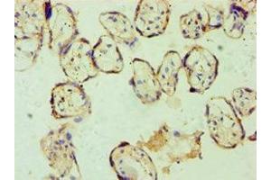 Immunohistochemistry of paraffin-embedded human placenta tissue using ABIN7153663 at dilution of 1:100 (Non-Syndromic Hearing Impairment Protein 5 (GSDME) (AA 1-260) 抗体)