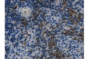 Detection of LSP1 in Rat Lymph node Tissue using Polyclonal Antibody to Lymphocyte Specific Protein 1 (LSP1) (LSP1 抗体  (AA 127-331))