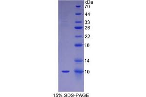 SDS-PAGE analysis of Human FGF3 Protein. (FGF3 蛋白)