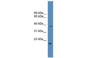 WB Suggested Anti-TIMP3 Antibody Titration: 0. (TIMP3 抗体  (Middle Region))