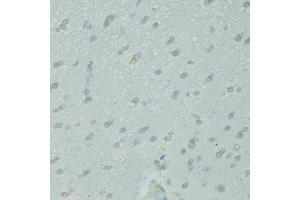 Immunohistochemistry of paraffin-embedded rat brain using NCOA2 antibody. (NCOA2 抗体)