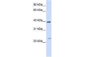 ACADL antibody used at 1 ug/ml to detect target protein.