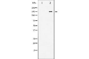 Western blot analysis of VEGFR2 phosphorylation expression in Na3VO4 treated HepG2 whole cell lysates,The lane on the left is treated with the antigen-specific peptide. (VEGFR2/CD309 抗体  (pTyr1214))