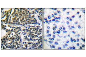 Immunohistochemistry (IHC) image for anti-Heat Shock Protein 90kDa alpha (Cytosolic), Class B Member 1 (HSP90AB1) (Ser254) antibody (ABIN1847890) (HSP90AB1 抗体  (Ser254))