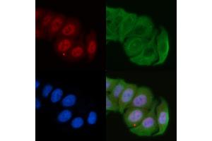 ABIN6266172 and ABIN6277194 staining Hela cells by IF/ICC.