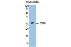 Detection of Recombinant ADRP, Human using Polyclonal Antibody to Adipose Differentiation Related Protein (ADRP) (ADRP 抗体  (AA 5-232))