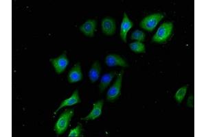 Immunofluorescence staining of A549 cells with ABIN7145367 at 1:133, counter-stained with DAPI. (B3GALT2 抗体  (AA 201-422))
