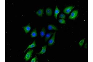 Immunofluorescence (IF) image for anti-UDP-Gal:betaGlcNAc beta 1,3-Galactosyltransferase, Polypeptide 2 (B3GALT2) (AA 201-422) antibody (ABIN7145367)