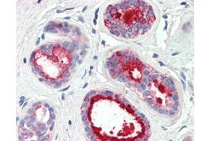 Anti-PIP / GCDFP15 antibody IHC of human breast. (PIP 抗体  (AA 24-34))