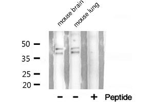 Western blot analysis of hnRNP A2/B1 expression in HepG2 cells (HNRNPA2B1 抗体  (N-Term))