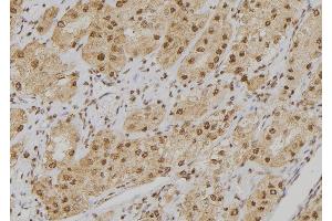 ABIN6273549 at 1/100 staining Human kidney tissue by IHC-P. (POGZ 抗体  (Internal Region))