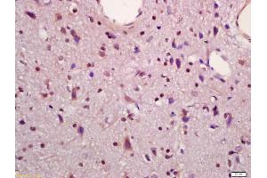 Formalin-fixed and paraffin embedded rat brain labeled with Anti-MAPKAPK5 Polyclonal Antibody, Unconjugated (ABIN754378) at 1:200 followed by conjugation to the secondary antibody and DAB staining (MAPKAP Kinase 5 抗体  (AA 89-190))