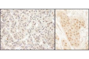 Immunohistochemistry (IHC) image for anti-Kinesin Family Member 2C (KIF2C) (AA 50-100) antibody (ABIN7454675)