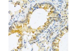 Immunohistochemistry of paraffin-embedded Mouse lung using IL20 Polyclonal Antibody at dilution of 1:100 (40x lens). (IL-20 抗体)
