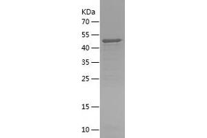 Western Blotting (WB) image for Abelson Helper Integration Site 1 (AHI1) (AA 1-335) protein (His tag) (ABIN7283389) (AHI1 Protein (AA 1-335) (His tag))