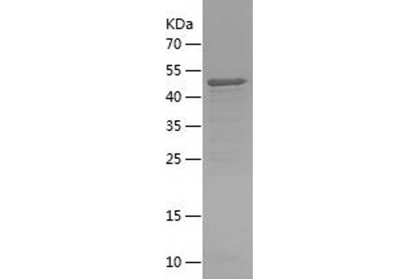 AHI1 Protein (AA 1-335) (His tag)