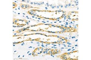 Immunohistochemistry of paraffin embedded human kidney using ATP1HC1 (ABIN7073160) at dilution of 1:500 (400x lens) (ATP12A 抗体)