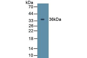 Detection of Recombinant IL27, Human using Polyclonal Antibody to Interleukin 27A (IL27A) (IL27 抗体  (AA 1-173))