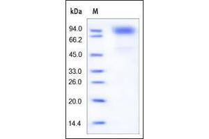 SDS-PAGE (SDS) image for Colony Stimulating Factor 3 Receptor (Granulocyte) (CSF3R) (AA 25-621) protein (His tag) (ABIN2181144)