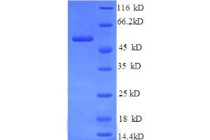 SDS-PAGE (SDS) image for Islet Cell Autoantigen 1, 69kDa (ICA1) (AA 1-268), (partial) protein (His tag) (ABIN5713518) (ICA1 Protein (AA 1-268, partial) (His tag))