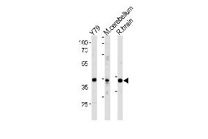 NeuroD1 Antibody  (ABIN388766 and ABIN2839060) western blot analysis in Y79 cell line ,mouse cerebellum and rat brain tissue lysates (35 μg/lane). (NEUROD1 抗体  (C-Term))
