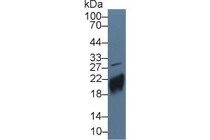 Western Blot; Sample: Human JAR cell lysate; ;Primary Ab: 5µg/ml Rabbit Anti-Human CGb Antibody;Second Ab: 0. (CGB 抗体  (AA 31-165))