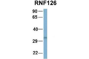 Host:  Rabbit  Target Name:  NOP56  Sample Type:  Human Fetal Brain  Antibody Dilution:  1. (RNF126 抗体  (N-Term))
