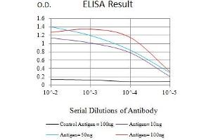Black line: Control Antigen (100 ng),Purple line: Antigen (10 ng), Blue line: Antigen (50 ng), Red line:Antigen (100 ng) (COL1A2 抗体  (AA 23-79))