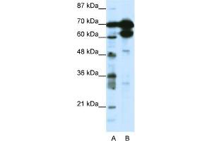 WB Suggested Anti-ZNF76 Antibody Titration:  1. (ZNF76 抗体  (N-Term))