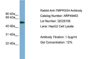 WB Suggested Anti-TMPRSS4  Antibody Titration: 0. (TMPRSS4 抗体  (Middle Region))