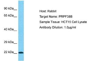 Host: Rabbit Target Name: PRPF38B Sample Type: HCT15 Whole Cell lysates Antibody Dilution: 1. (PRPF38B 抗体  (Middle Region))